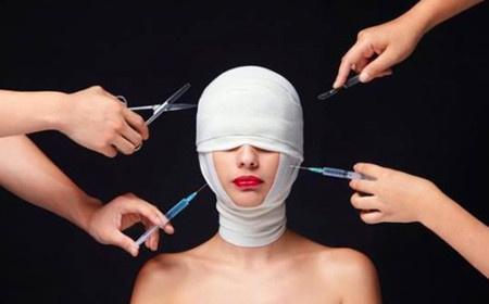 有谁做过整形手术